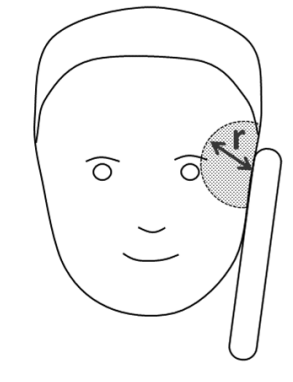 Schematische Kopfzeichnung mit markiertem, schraffiertem Kreis an der Schläfe und Pfeil 'r'.
